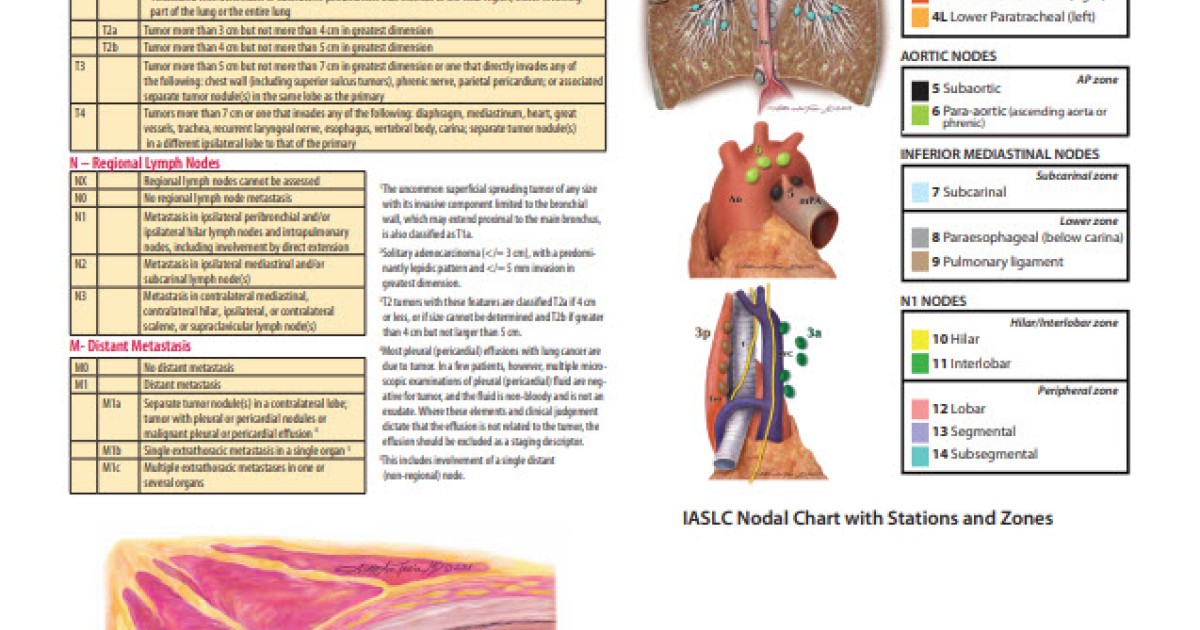Poster 8th Edition Lung Cancer TNM Staging Summary Poster
